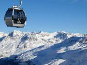 Blick von der Hohen Mut über das Skigebiet