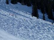 Buckel sind eine Herausforderung