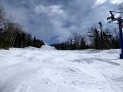 Buckelpiste unterhalb der Vierersesselbahn